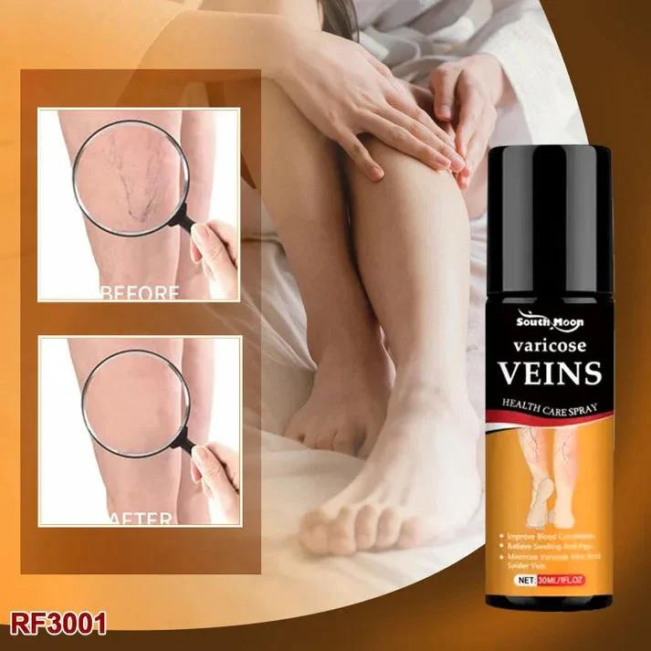 BEE VENOM VARICOSE VEINS RELIEF SPRAY (BUY 1 GET 1 FREE)(PACK OF 2)